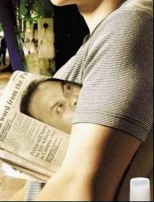 狐臭是什么味道 改良小切口汗腺清除术前后对比.gif